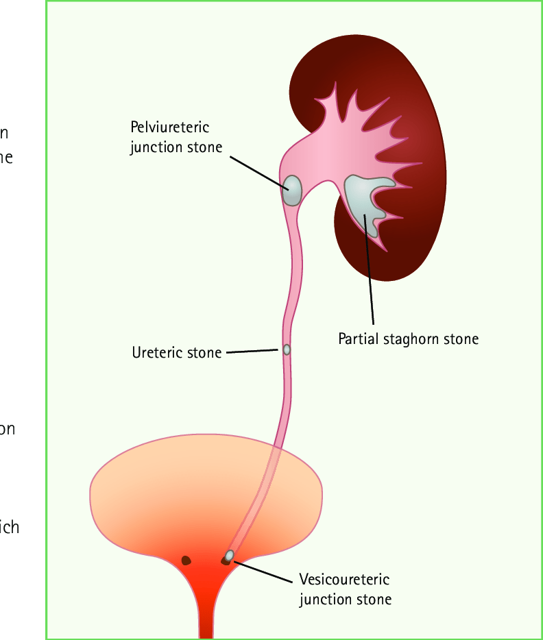 bladder