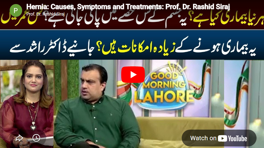 Hernia: Causes, Symptoms and Treatments: Prof. Dr. Rashid Siraj